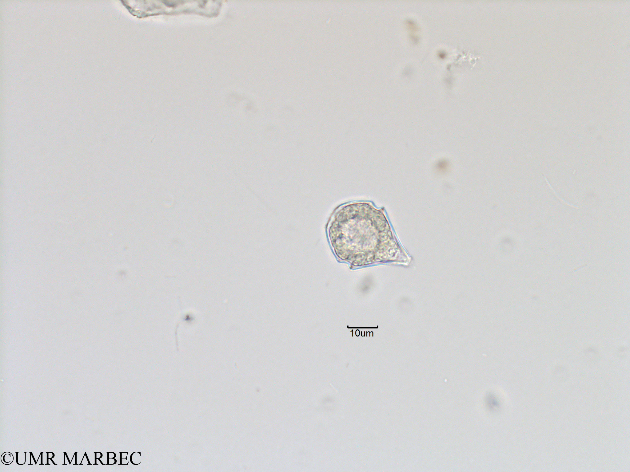 phyto/Bizerte/bizerte_bay/RISCO November 2015/Scrippsiella spinifera (ancien Scrippsiella spp-Baie_T5-ACW1-cf Scrippsiella-1).tif(copy).jpg